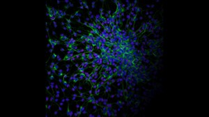 Neuro-immuneAxis_2025_location_image